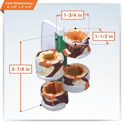 GPI Anatomicals 4-Piece Bronchus Model, Replica with Pathologies - style: Bronchus Model