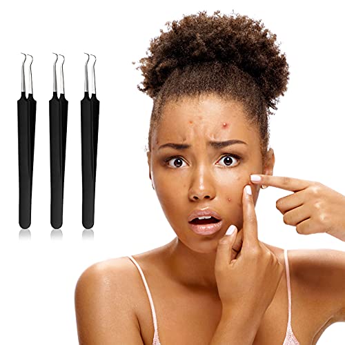 Honoson 3 Pcs Blackhead Tweezers Stainless Steel Tip Tool, Black - color: Black