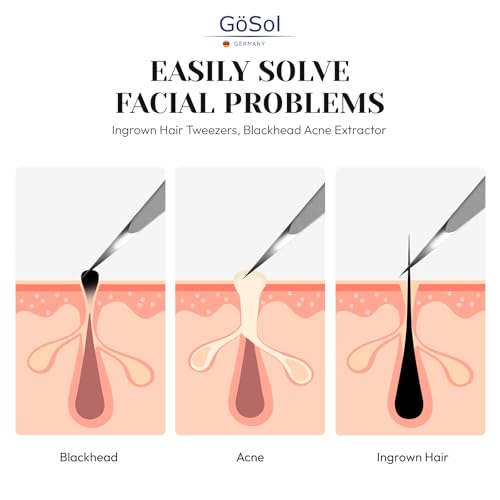 Tweezers - Professional Pointed Tweezers for Women and Men