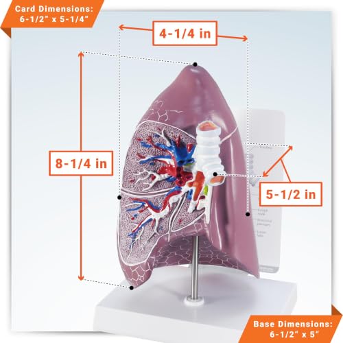 GPI Anatomicals Lung Model - style: Lung Model