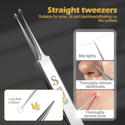 WSYUB Professional Blackhead Tweezers,Ingrown Hair Removal Kit - color: Starlight Silver