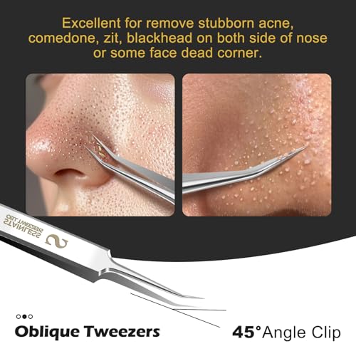 WSYUB Professional Blackhead Tweezers,Ingrown Hair Removal Kit - color: Starlight Silver