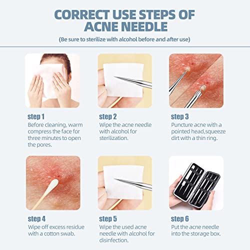 JPNK Blackhead Remover Comedone Extractor Acne Removal Kit.. - color: Silver